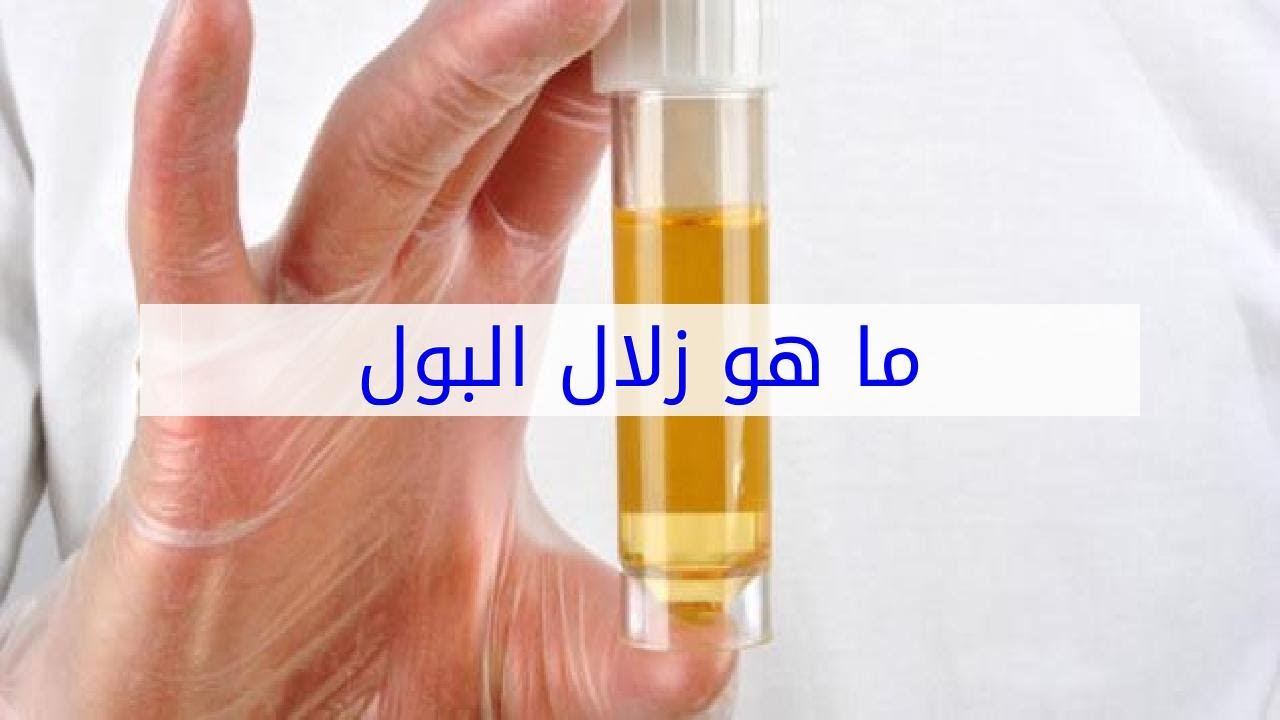 أعراض مرض الزلال