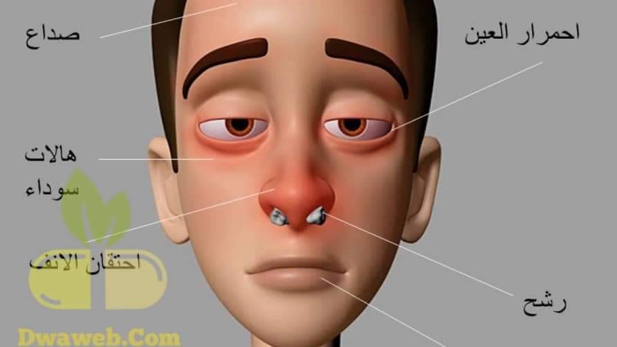 حساسية الانف والعين